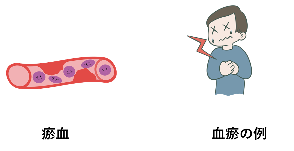 瘀血（おけつ）と血瘀（けつお）の違い | ミヂカナ薬局｜漢方相談・薬膳食材専門｜大阪 吹田 阪急関大前